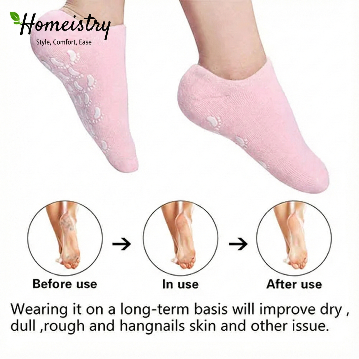 Before and after comparison of dry cracked heels versus smooth heels, showing the benefits of wearing Homeistry gel socks.