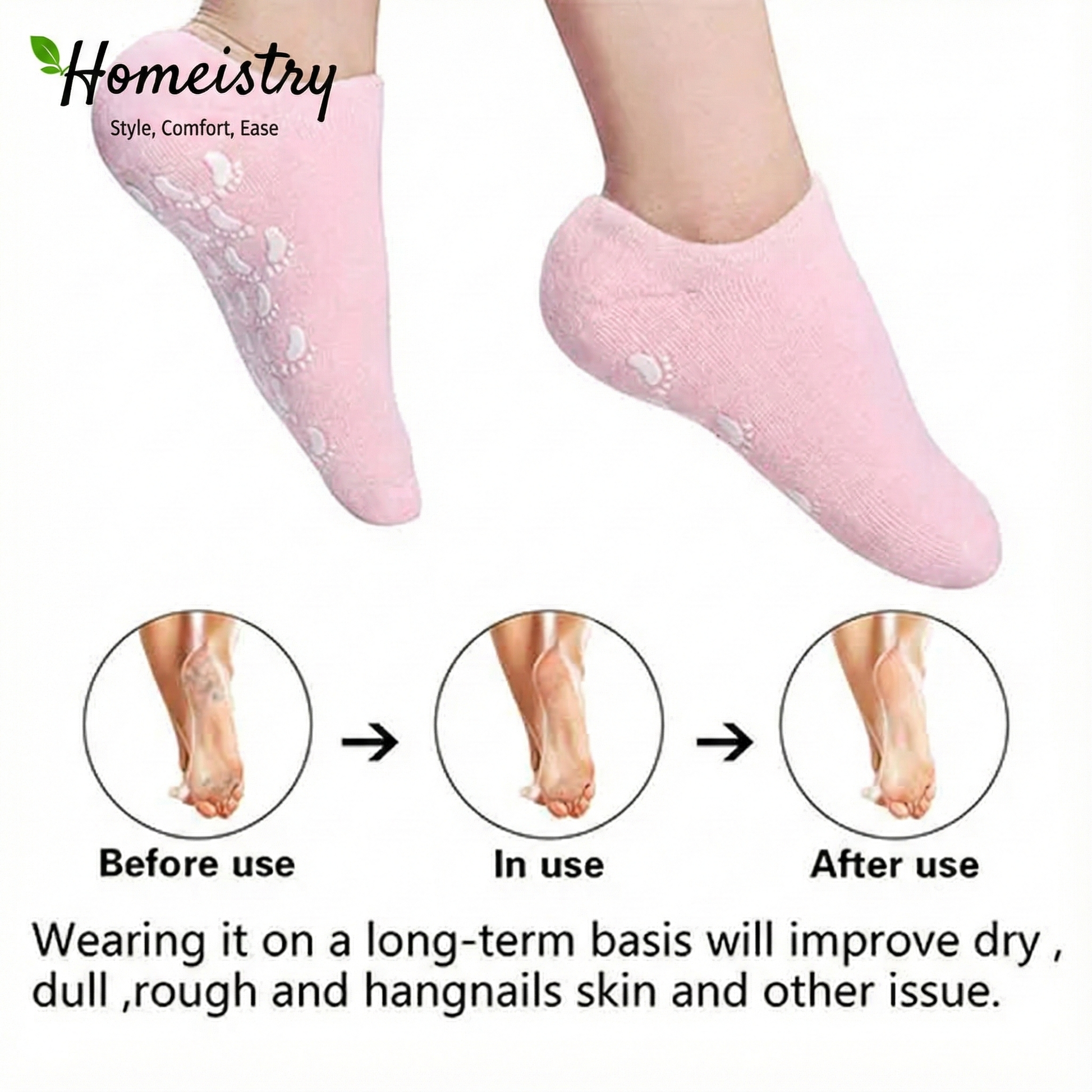 Before and after comparison of dry cracked heels versus smooth heels, showing the benefits of wearing Homeistry gel socks.