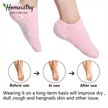 Before and after comparison of dry cracked heels versus smooth heels, showing the benefits of wearing Homeistry gel socks.